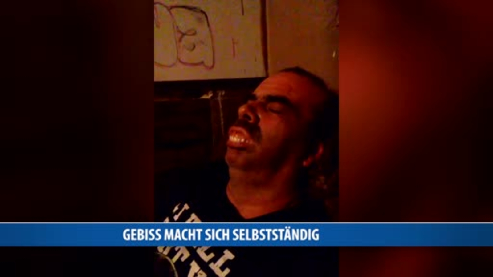 Gebiss Macht Sich Selbstst Ndig