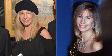 Barbra Streisand wirkt unnatürlich jung