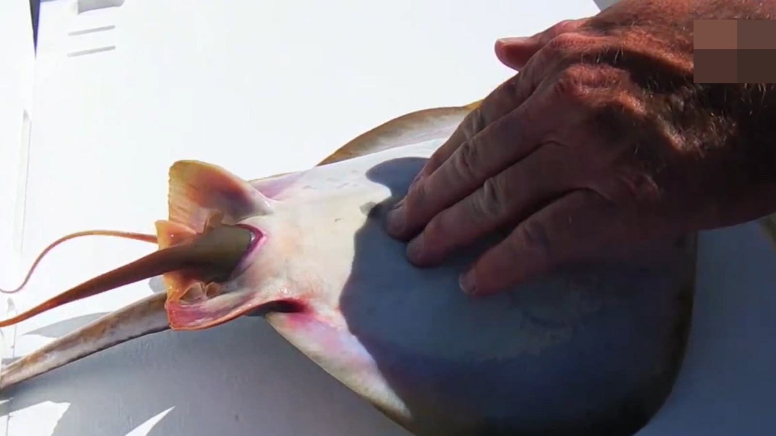 Mensch gebärt Stachelrochen