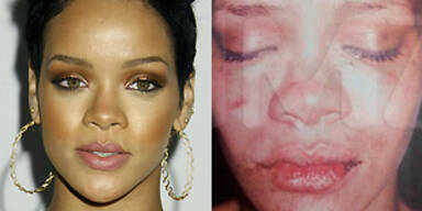So schlimm wurde Rihanna verprügelt