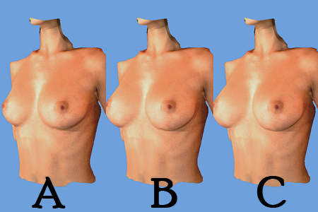 3 Der neue 3D-Scan