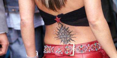 Wie wird man ein Tattoo wieder los?