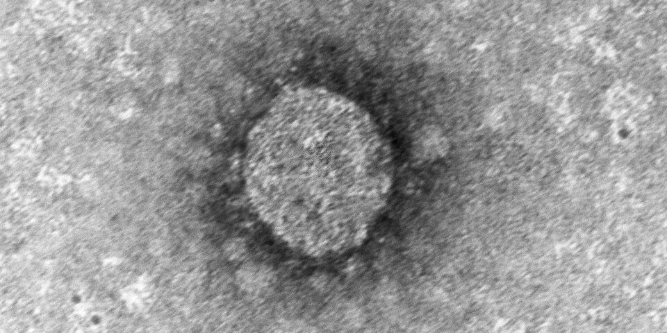 So sieht das 'österreichische' Coronavirus aus