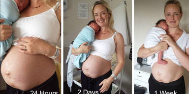 Babybauch