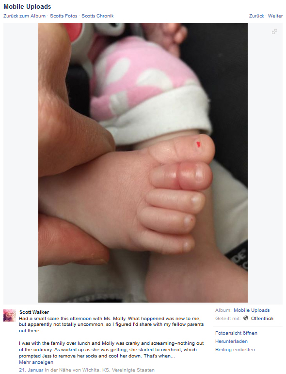 Babyfuß