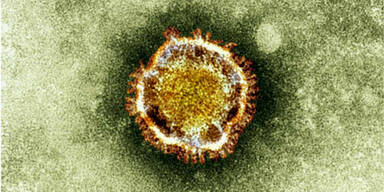 Coronavirus: US-Forscher arbeiten an Impfstoff