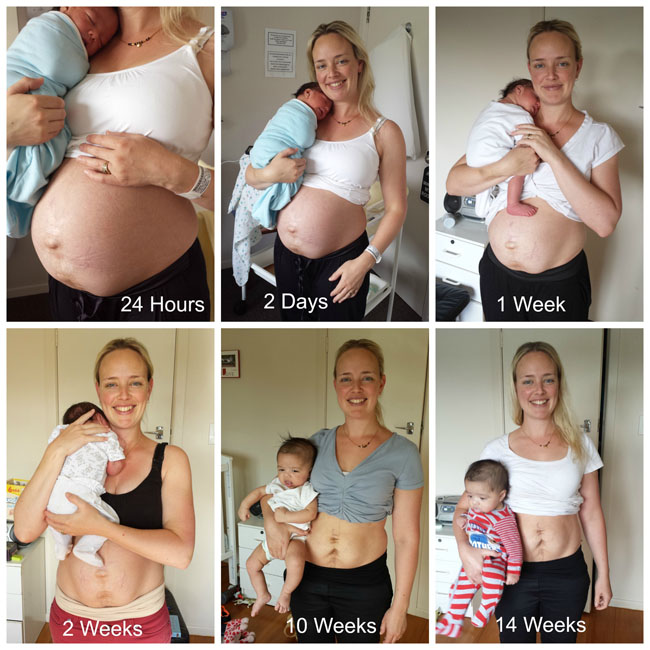 So sieht ein After-Baby-Body wirklich aus