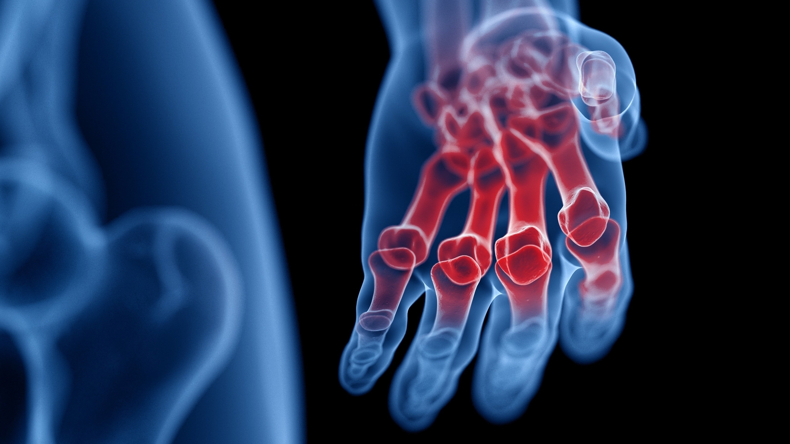 Wenn die Finger schmerzen gesund24.at