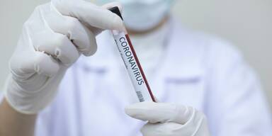Coronavirus Probe