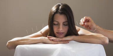 Sinnvoller Einsatz von Akupunktur