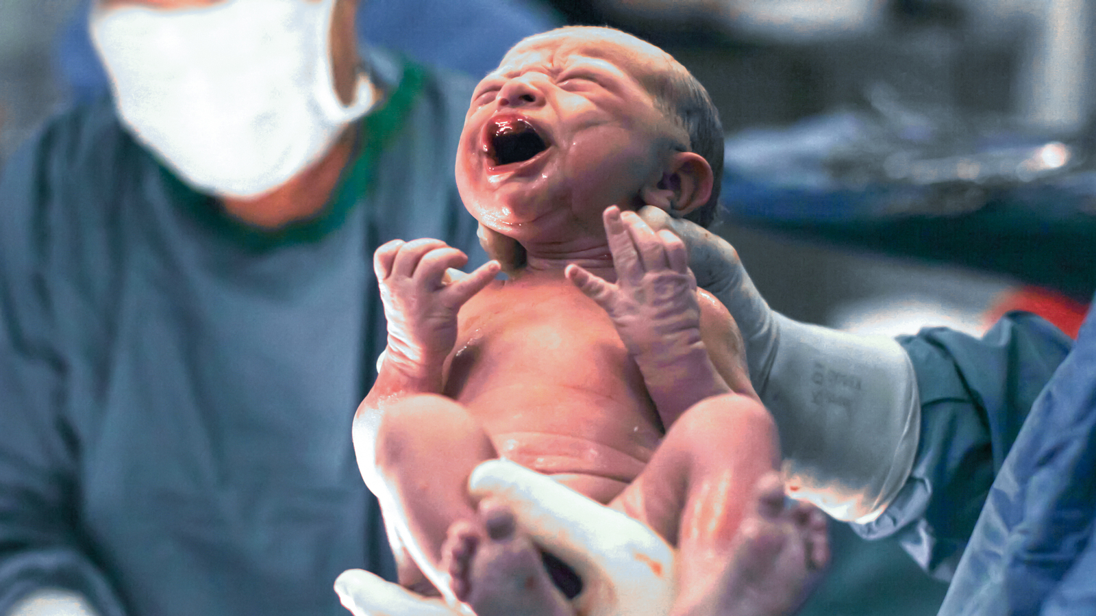 Medizinisches Wunder Baby mit zwei funktionsfähigen Penissen geboren