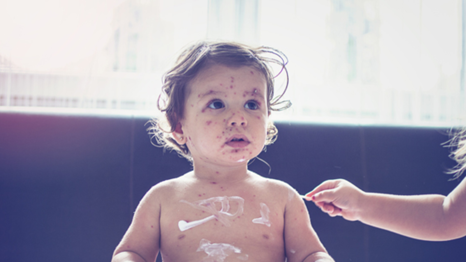 Immer mehr MasernTote auf den Philippinen