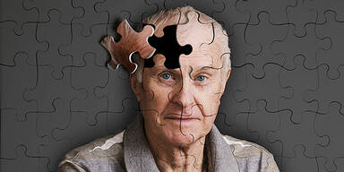 Alzheimer Symbolbild