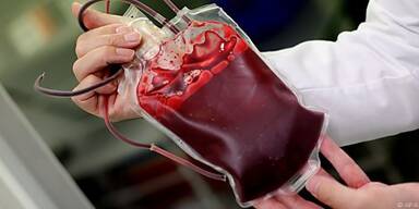 Hohes Risiko bei Bluttransfusionen vor 1990