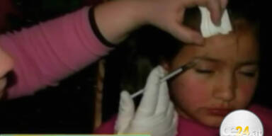 8-Jähriger Botox gespritzt - Sorgerecht weg