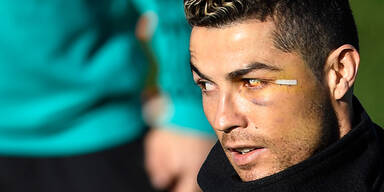 Ronaldo Gesichtsverletzung