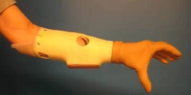 Freiwillige Arm-Amputation eines Wieners