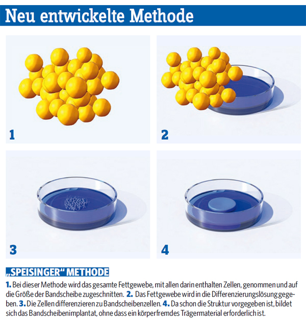 Speisinger Methode