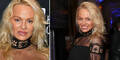 Pamela Anderson: Frisch operiert