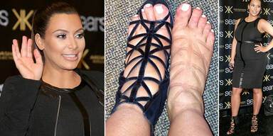 Kim Kardashian: Geschwollene Füße