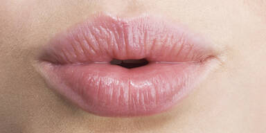 4 SOS-Tipps für weiche Lippen