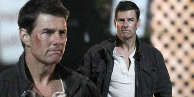 Tom Cruise mit böser Gesichtsverletzung