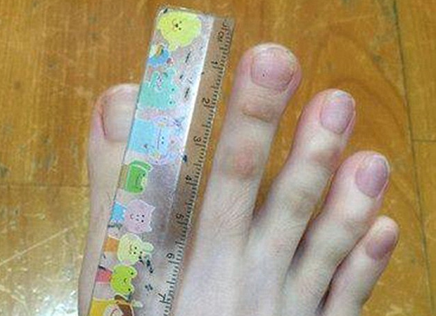 Finger oder Zehen? Foto lässt Netz ausflippen