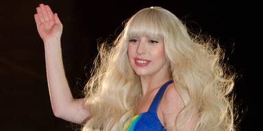 Lady Gaga: Wild auf Faltenunterspritzungen