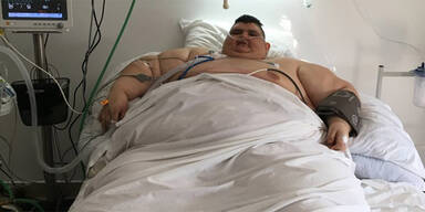 Dickster Mann der Welt will 375 kg abnehmen