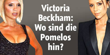 Knochengerüst Vic Beckham