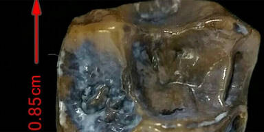 Rätsel um Millionen Jahre alte Zähne