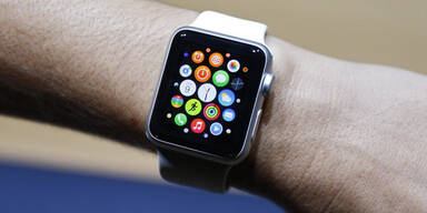 Apple Watch versagt bei Akku-Laufzeit