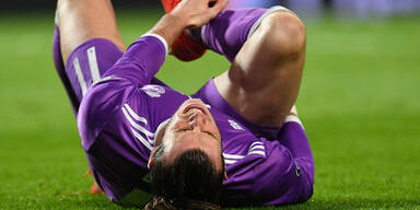 Schock: Superstar Bale verletzt