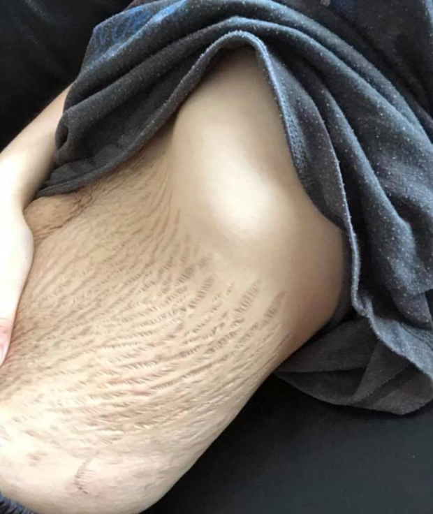 Attacken gegen Mutter wegen Bauch-Fotos