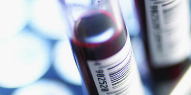 Blut