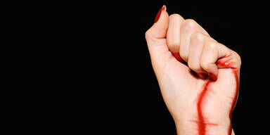 Darum schwitzt diese Frau Blut statt Schweiß