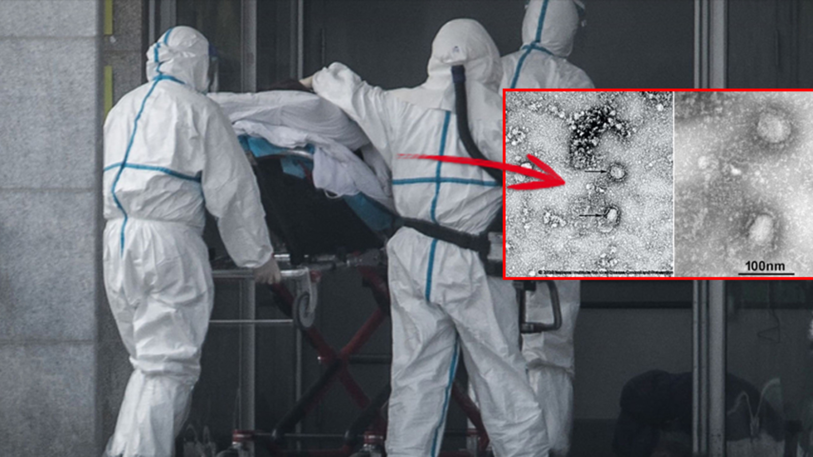 Tödliches Virus Breitet Sich Weiter Aus Die Angst Geht Um - g9pdrli