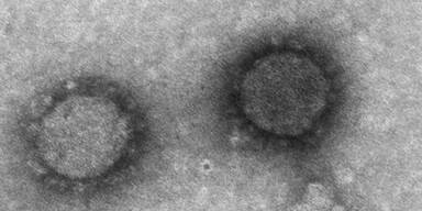 So sieht das 'österreichische' Coronavirus aus