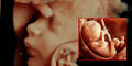 3D-Ultrasound zeigt Ungeborene klar wie nie