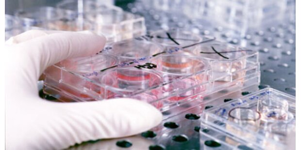 Bluttest soll Krebs und MS erkennen