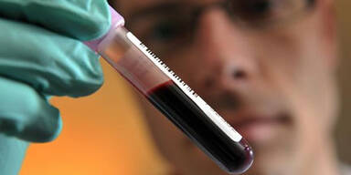 HCB: Jede 6. Blutprobe belastet