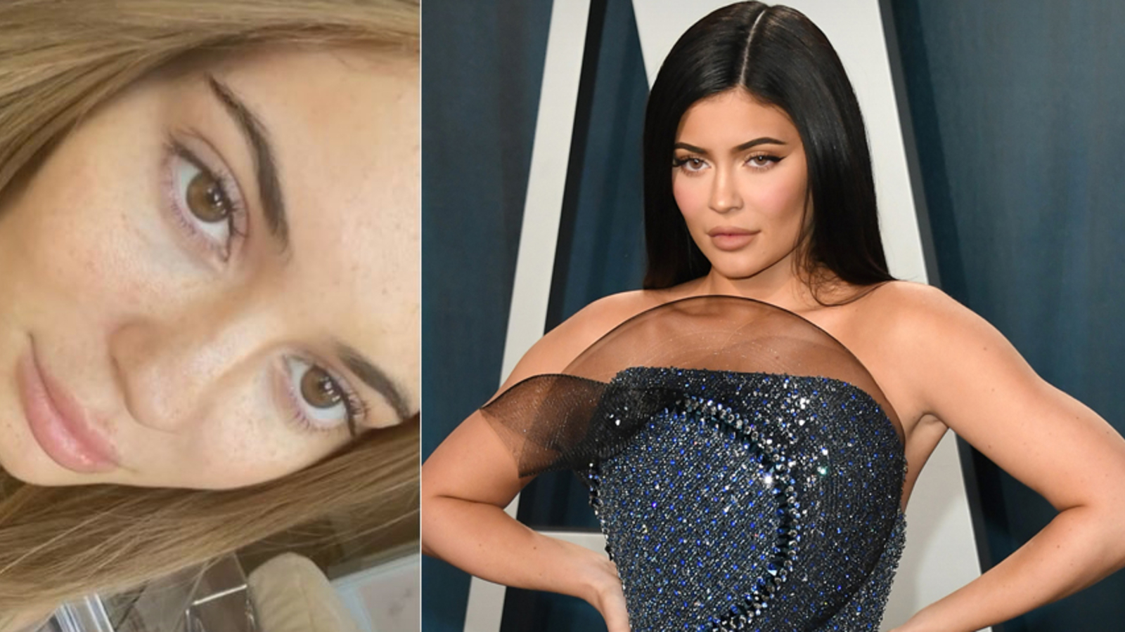 Wow Kylie Jenner Zeigt Sich Ganz Natürlich Oe24at 