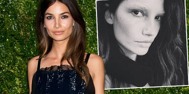 Lily Aldridge