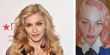 Botox-Fail von Madonna auf Instagram