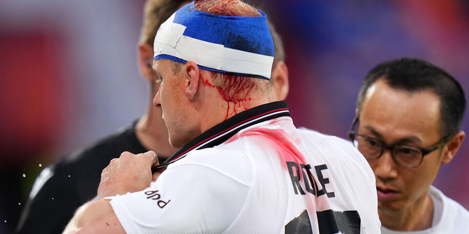 Blut-Schock bei Eintracht-Star Rode