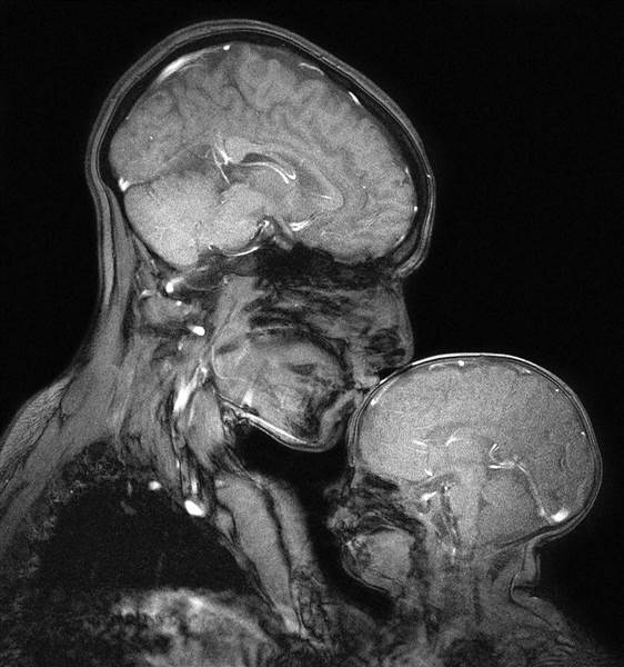Brains