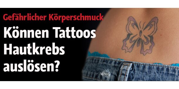 Können Tattoos Hautkrebs auslösen?
