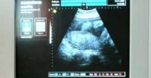 ultraschall